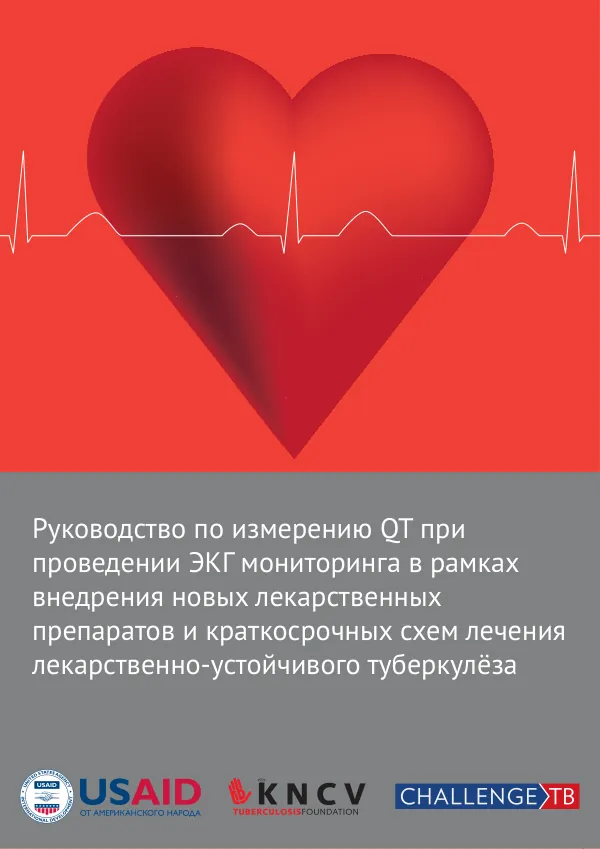 Guidance on requirements for QTc measurement in ECG monitoring when introducing new drugs and shorter regimens for the treatment of Multi/Extensively Drug-Resistant Tuberculosis