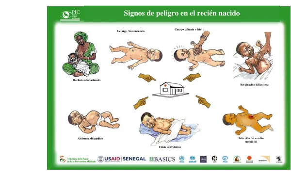 Signos de peligro en el recién nacido