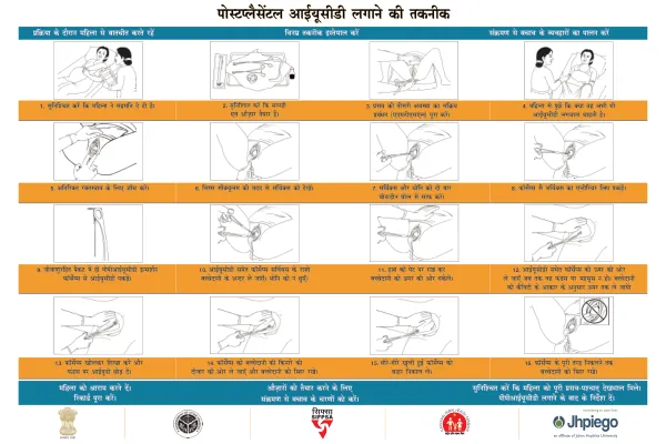 PPIUCD Insertion Steps-Hindi-24inx36in