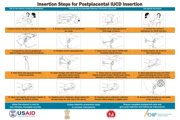 Insertion Steps for Postplacental IUCD Insertion